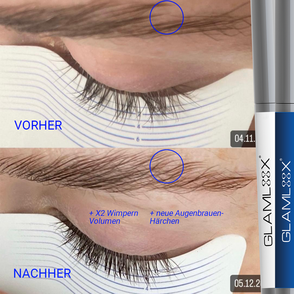 Kosmetikerin verwendet Wimpernserum ohne Hormone bei Kundin für natürliche Wimpernverlängerung - Vorher Nachher