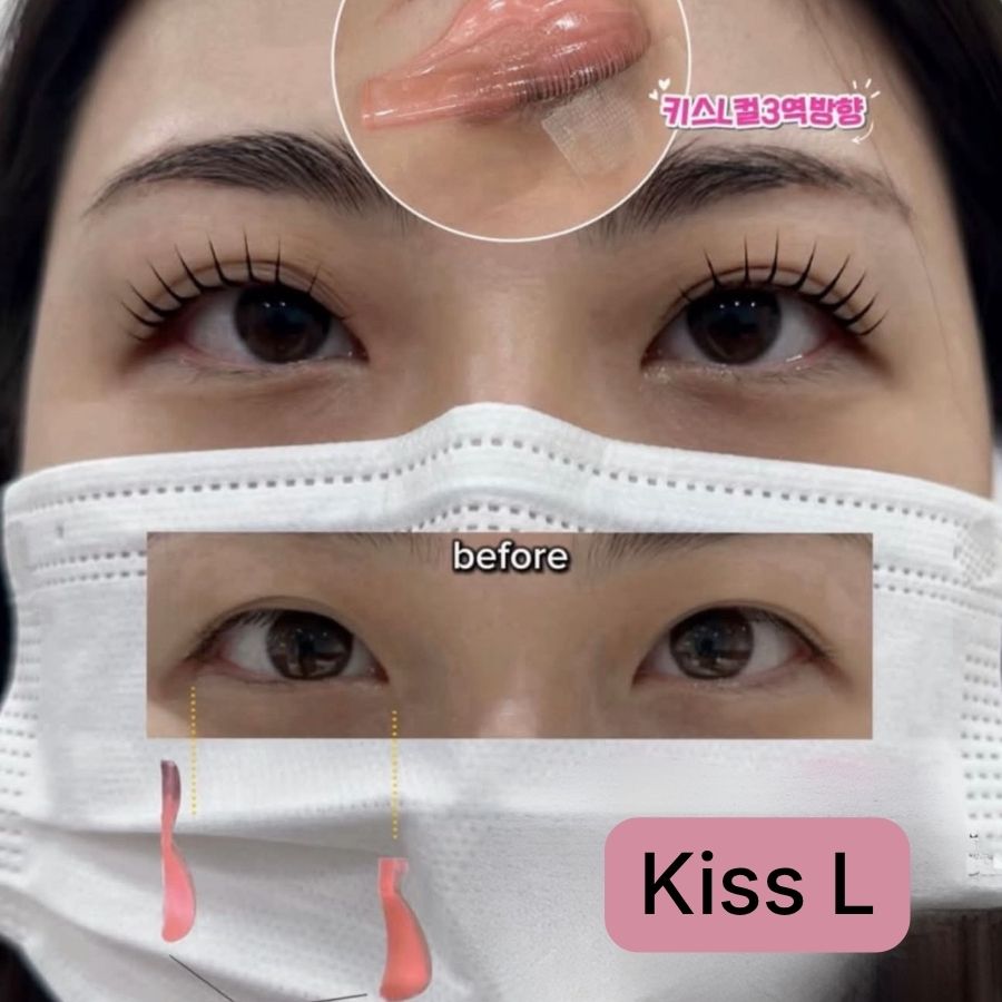 Koreanisches Silikonpad Kiss L - Rod von A.DAN