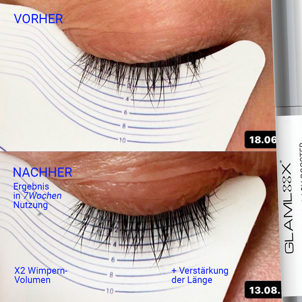 Vorher-Nachher Ergebnis mit Wimpernserum ohne Hormone – sichtbare Verlängerung und Verdichtung der Wimpern