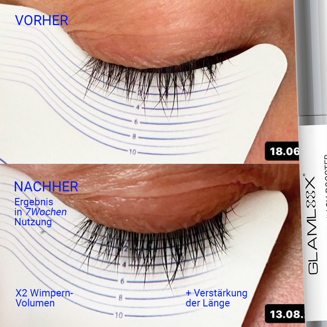 SET LASH&BROW BOOSTERS