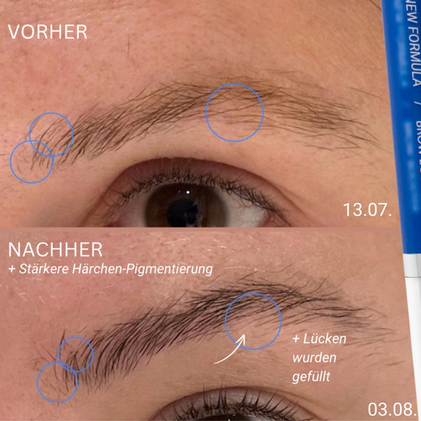 Wimpern- & Augenbrauenserum Set – Ohne Hormone & Prostaglandin - SET LASH&BROW BOOSTERS