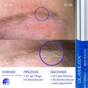Wimpern- & Augenbrauenserum Set – Ohne Hormone & Prostaglandin - SET LASH&BROW BOOSTERS